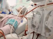 La malaltia renal crònica avança a Espanya amb milers de pacients en diàlisi o trasplantament